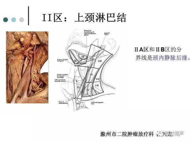 颈部淋巴结分区最新指南详解，理论与实践结合的研究论述